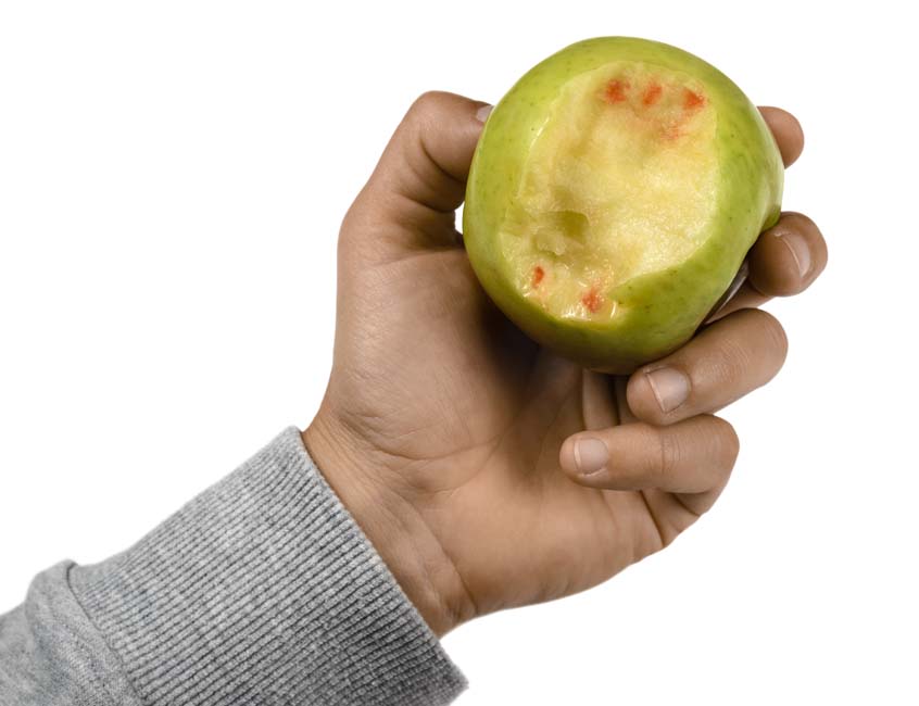 Parodontitis - Blutiger Apfel